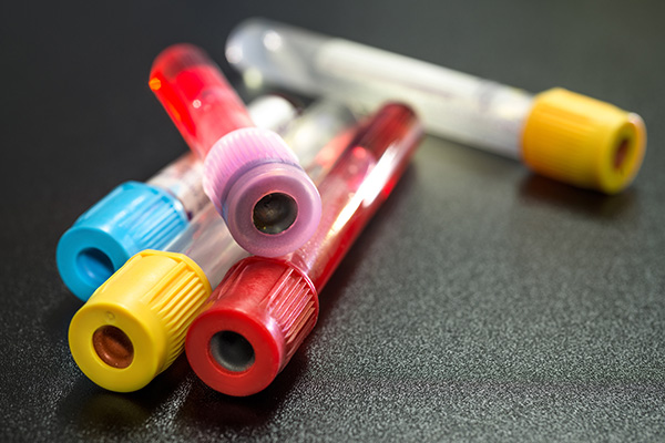 Image of test tubes